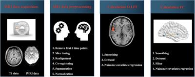 Frontiers Altered regional brain activity and functional